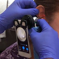 Top of the range equipment ear wax removal
